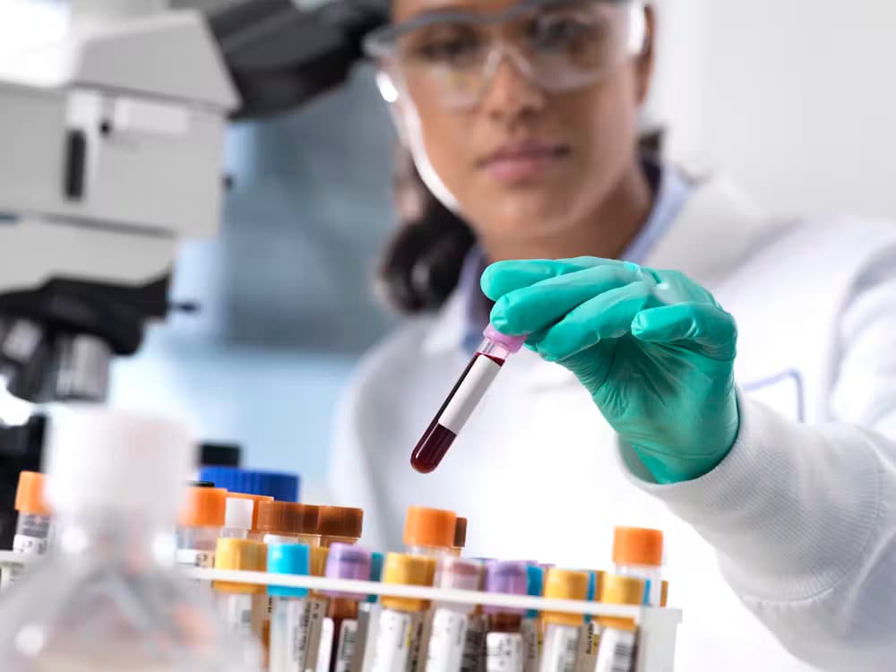 Wissenschaft bestätigt: Präanalytik ist entscheidend bei Blutentnahmen