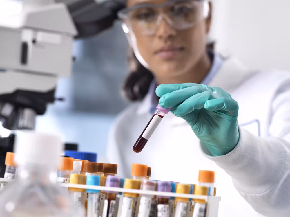 Wissenschaft bestätigt: Präanalytik ist entscheidend bei Blutentnahmen