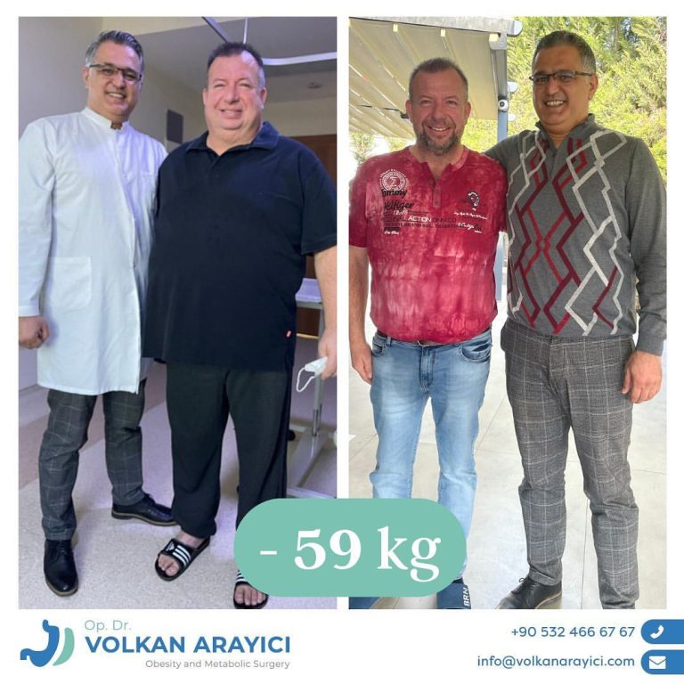 Türkei Spezial 2025 – wie teuer ist eine magenverkleinerung in Izmir?